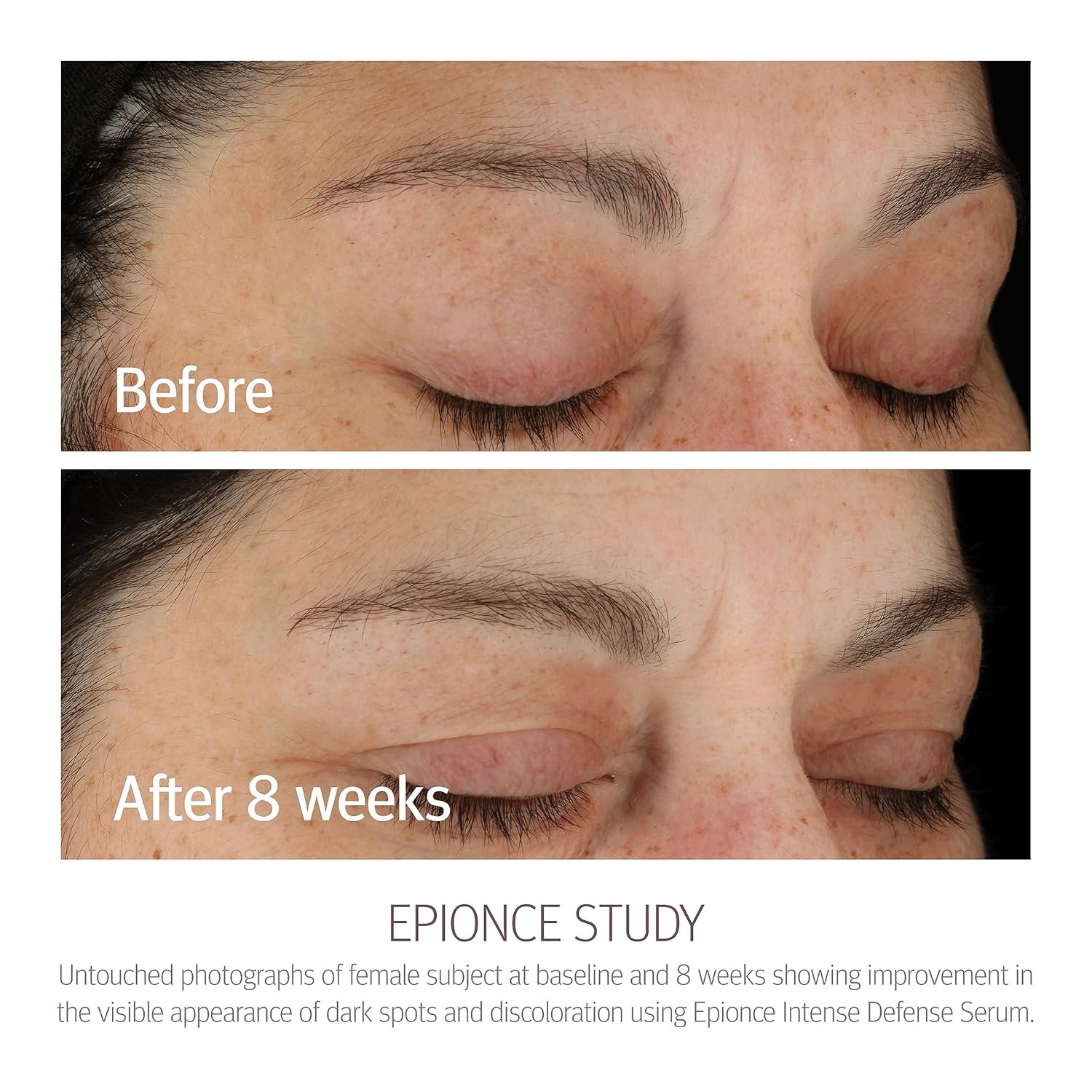 Epionce Intense Defense Serum - Anti-Aging Facial Serum with Vitamin C, Vitamin E, Vitamin D, A, B, & Niacinamide, Dermatologist Skincare - Image 3