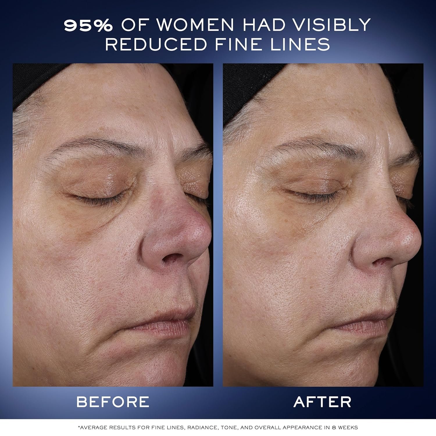 Lancôme Génifique Ultimate Dual Recovery Face Serum- Anti-Aging Serum Visibly Improves Fine Lines, Rough Texture, Plumpness and Even Skintone - with Beta Glucan and, Hyaluronic Acid - Image 4